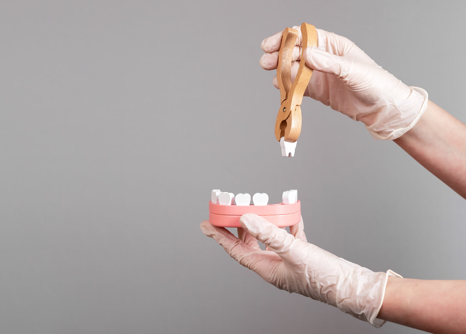 Muss ich meinen Zahn ziehen lassen?